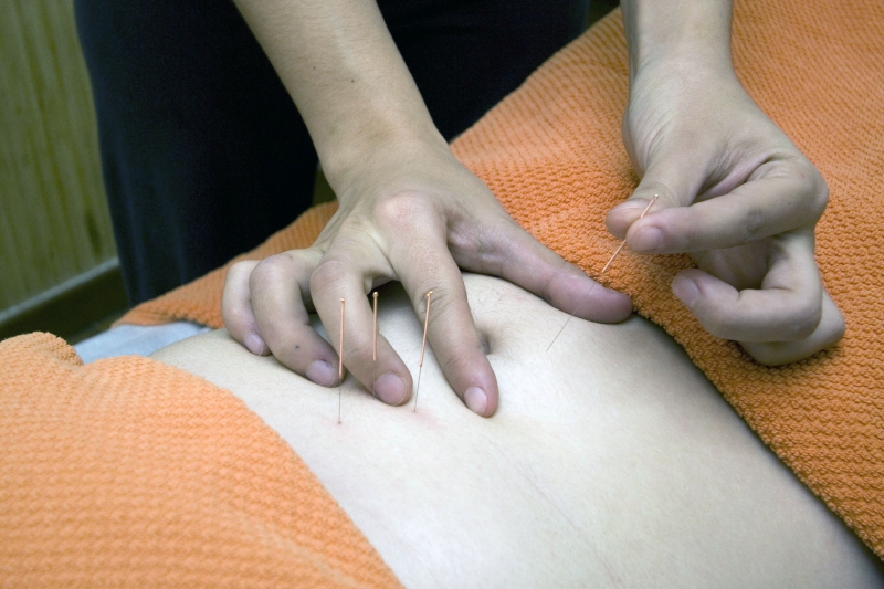 osteopathe-CANNES-min_acupuncture-4175625